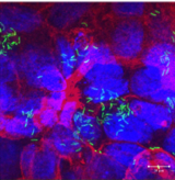 bacteria infection cell sheet